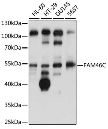 FAM46C Rabbit Polyclonal Antibody