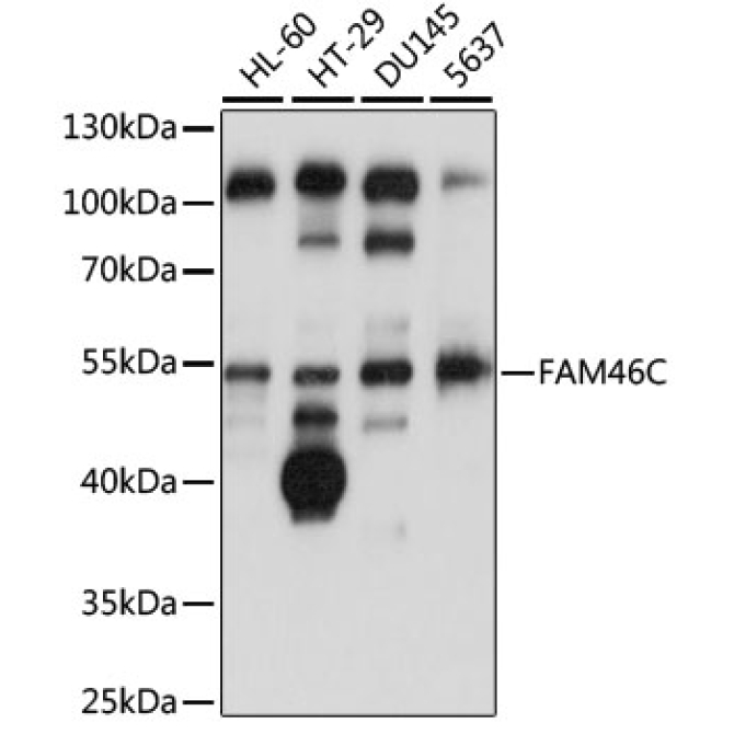 FAM46C Rabbit Polyclonal Antibody