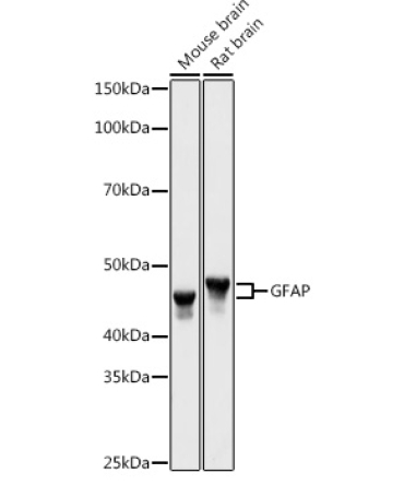 GFAP Rabbit Polyclonal Antibody