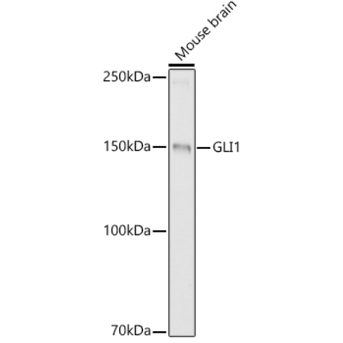 GLI1 Rabbit Polyclonal Antibody