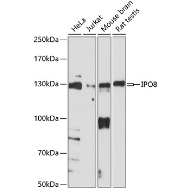 IPO8 Rabbit Polyclonal Antibody