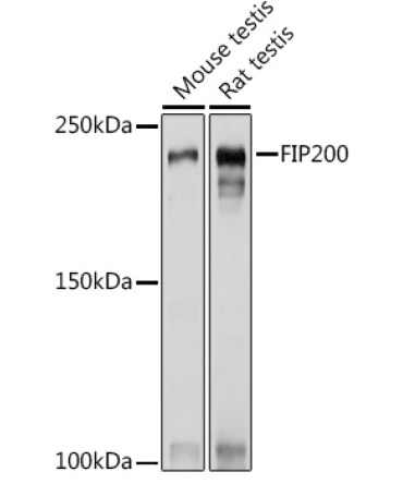 FIP200 Rabbit Polyclonal Antibody