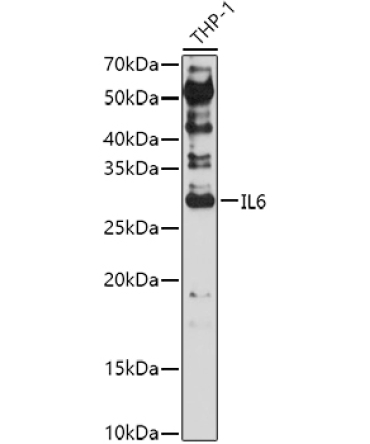 IL6 Rabbit Polyclonal Antibody