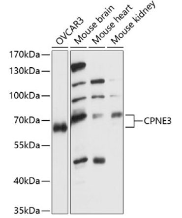 CPNE3 Rabbit Polyclonal Antibody