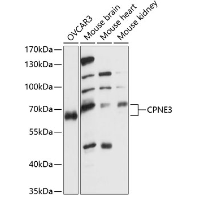 CPNE3 Rabbit Polyclonal Antibody