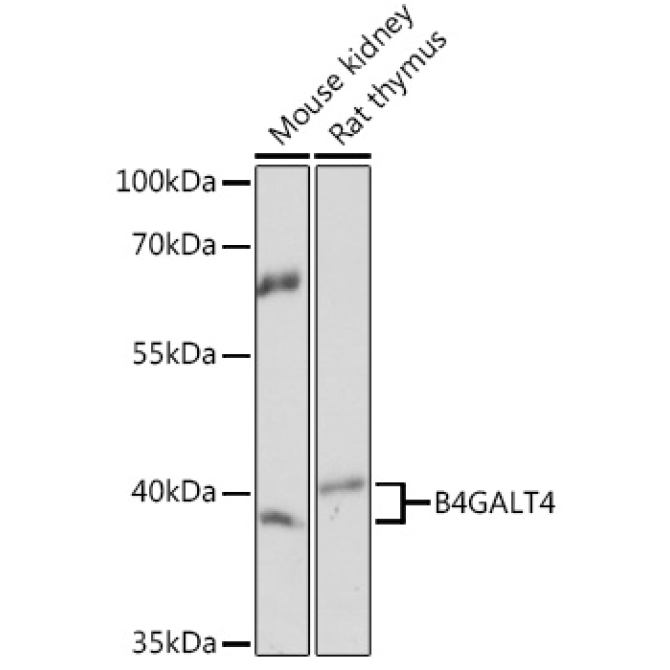 B4GALT4 Rabbit Polyclonal Antibody