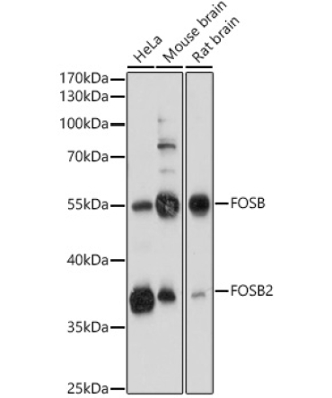 FOSB Rabbit Polyclonal Antibody