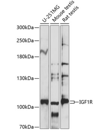 IGF1R Rabbit Polyclonal Antibody