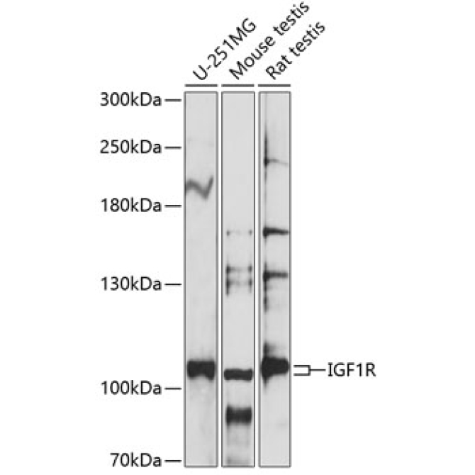IGF1R Rabbit Polyclonal Antibody