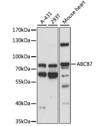 ABCB7 Rabbit Polyclonal Antibody
