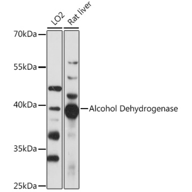Alcohol Dehydrogenase Rabbit Polyclonal Antibody