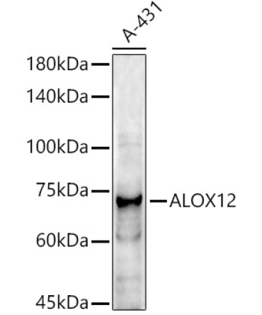 ALOX12 Rabbit Polyclonal Antibody