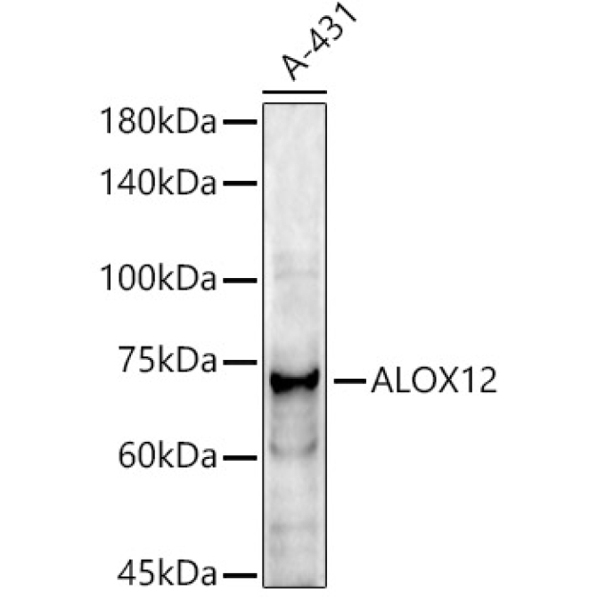 ALOX12 Rabbit Polyclonal Antibody