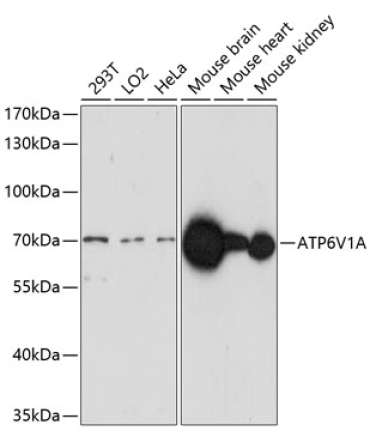 ATP6V1A Rabbit Polyclonal Antibody