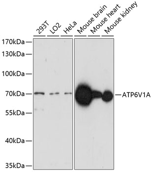 ATP6V1A Rabbit Polyclonal Antibody