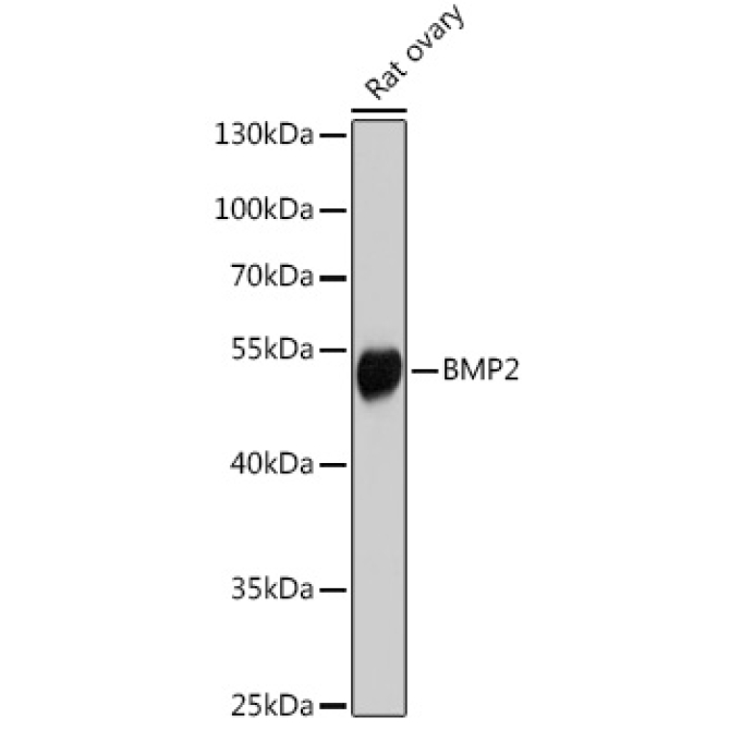 BMP2 Rabbit Polyclonal Antibody