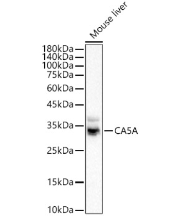CA5A Rabbit Polyclonal Antibody