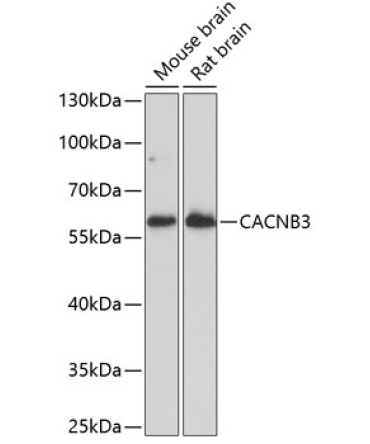 CACNB3 Rabbit Polyclonal Antibody