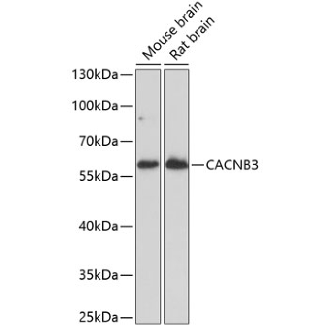 CACNB3 Rabbit Polyclonal Antibody