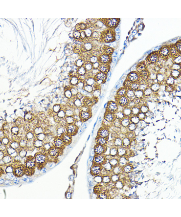 Calmodulin 1/2/3 Rabbit Polyclonal Antibody