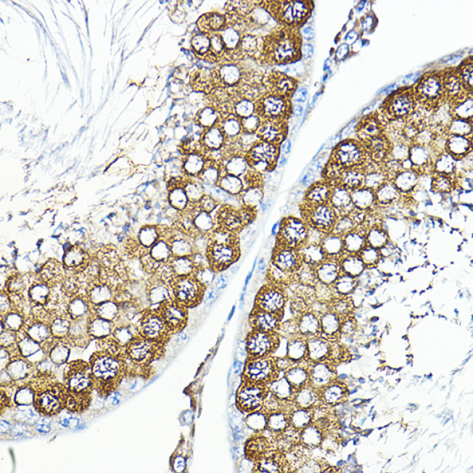 Calmodulin 1/2/3 Rabbit Polyclonal Antibody