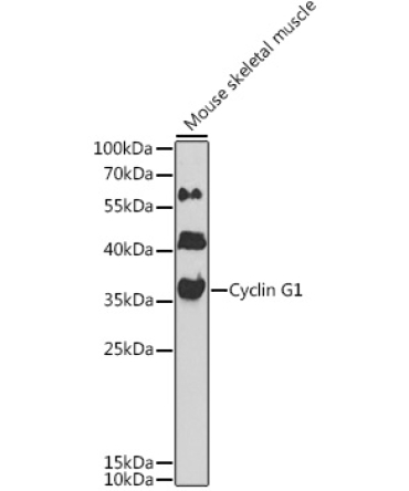 Cyclin G1 Rabbit Polyclonal Antibody