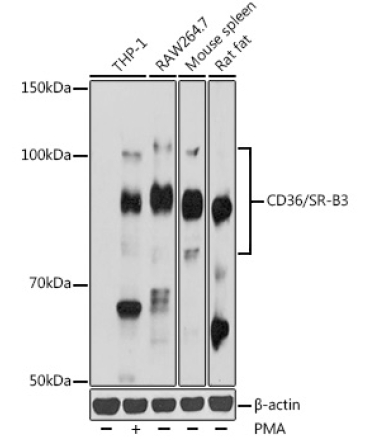 CD36/SR-B3 Rabbit Polyclonal Antibody