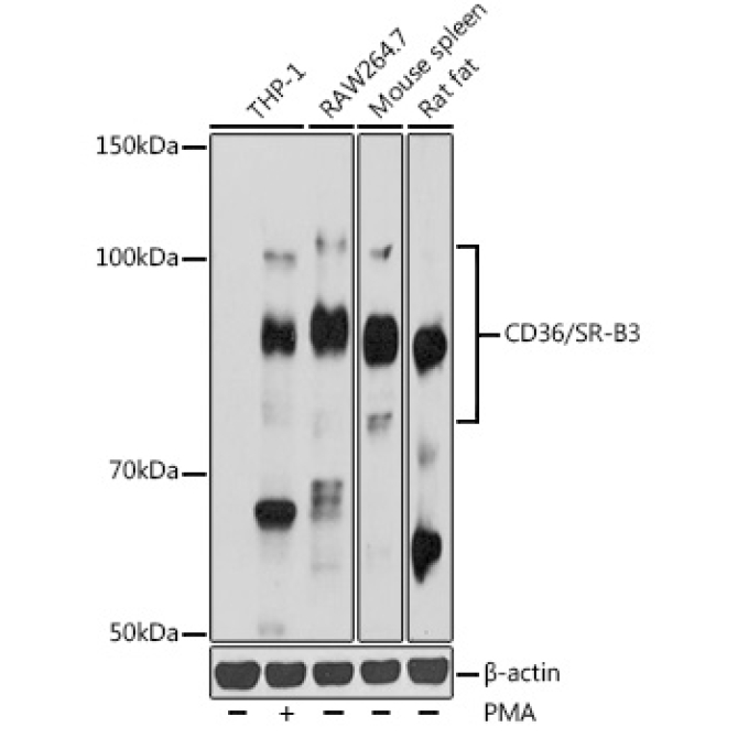 CD36/SR-B3 Rabbit Polyclonal Antibody