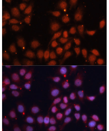 CDK11B Rabbit Polyclonal Antibody