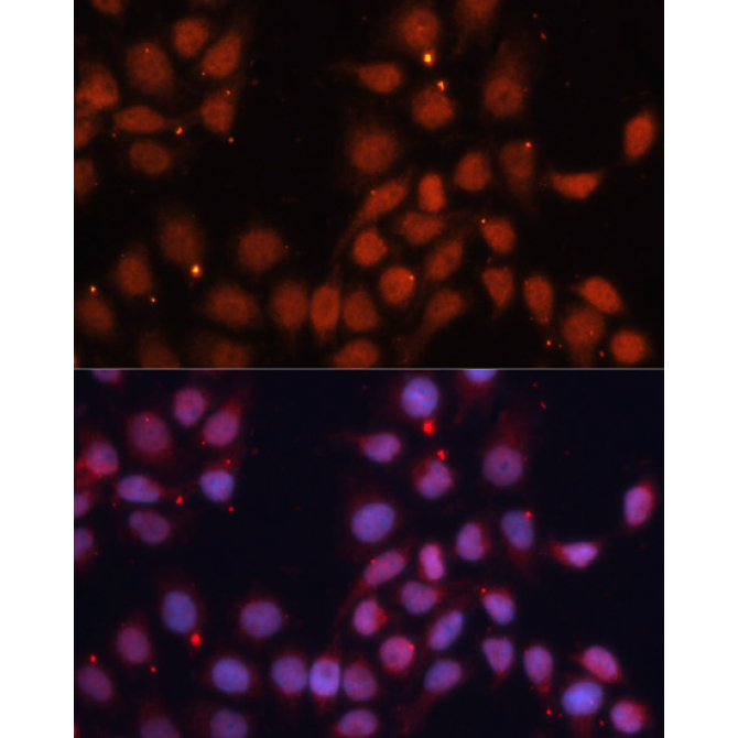 CDK11B Rabbit Polyclonal Antibody
