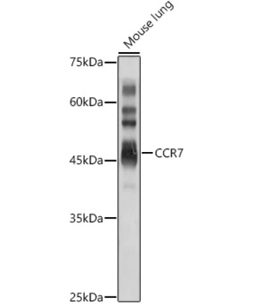 CCR7 Rabbit Polyclonal Antibody