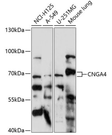 CNGA4 Rabbit Polyclonal Antibody