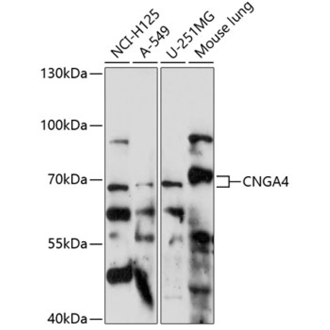 CNGA4 Rabbit Polyclonal Antibody