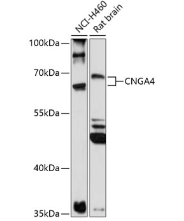 CNGA4 Rabbit Polyclonal Antibody