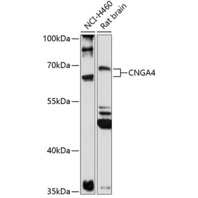 CNGA4 Rabbit Polyclonal Antibody