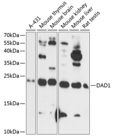 DAD1 Rabbit Polyclonal Antibody