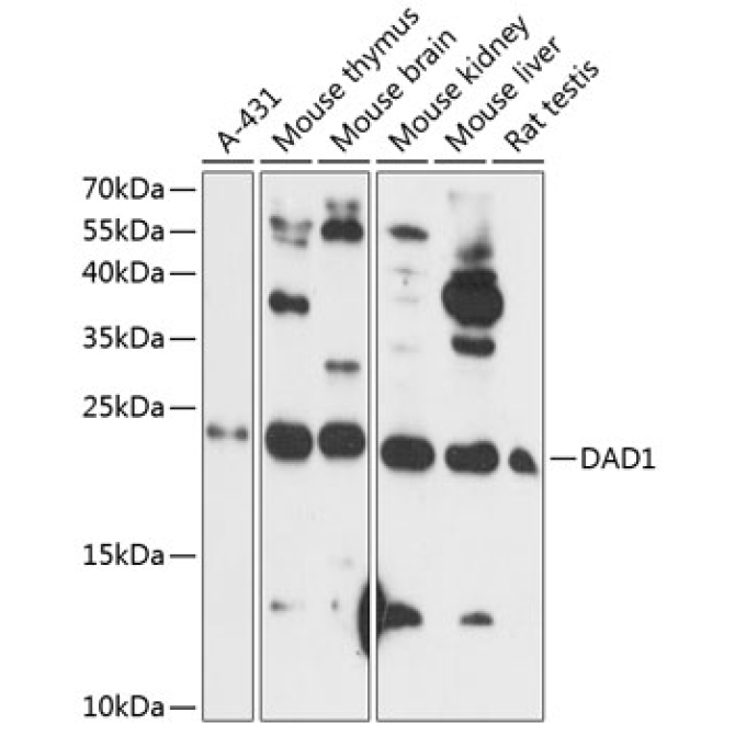DAD1 Rabbit Polyclonal Antibody