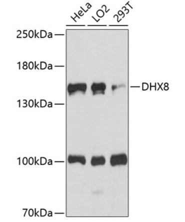 DHX8 Rabbit Polyclonal Antibody