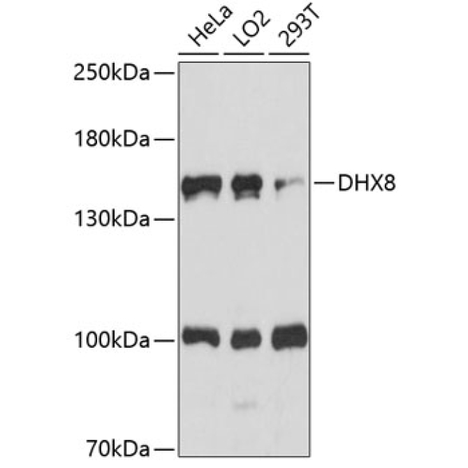 DHX8 Rabbit Polyclonal Antibody