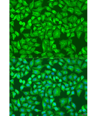 DVL2 Rabbit Polyclonal Antibody
