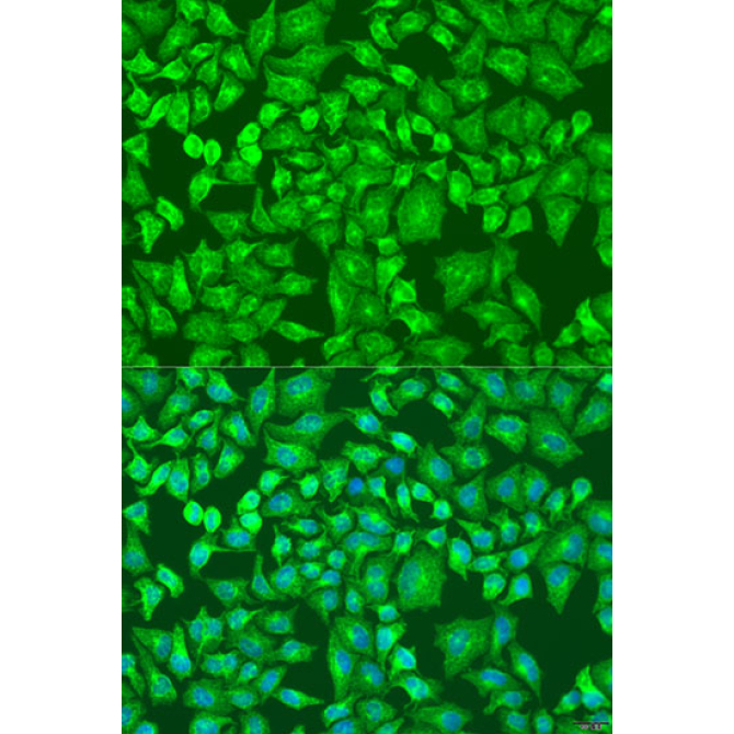 DVL2 Rabbit Polyclonal Antibody