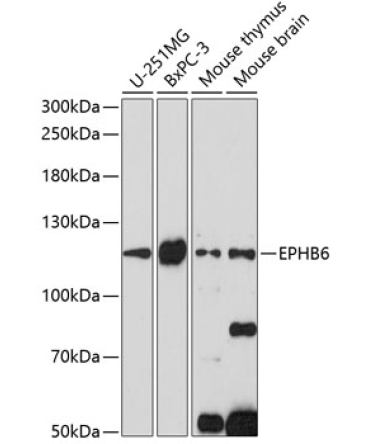 EPHB6 Rabbit Polyclonal Antibody
