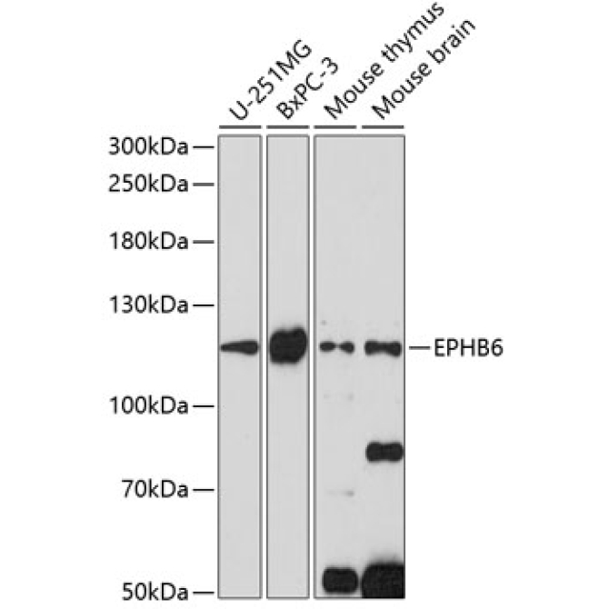 EPHB6 Rabbit Polyclonal Antibody