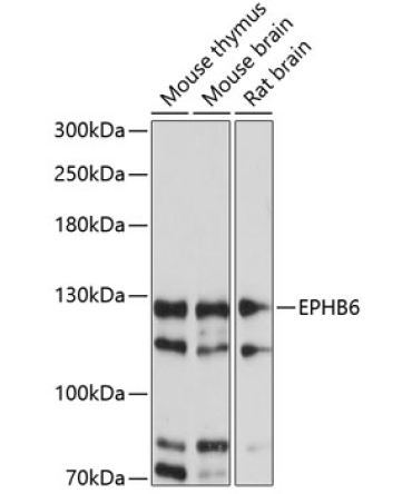 EPHB6 Rabbit Polyclonal Antibody