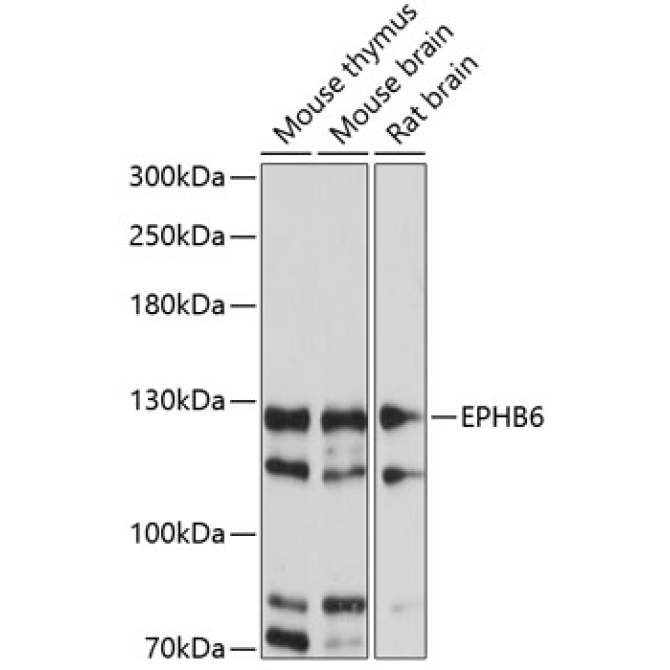 EPHB6 Rabbit Polyclonal Antibody