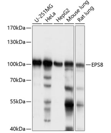 EPS8 Rabbit Polyclonal Antibody