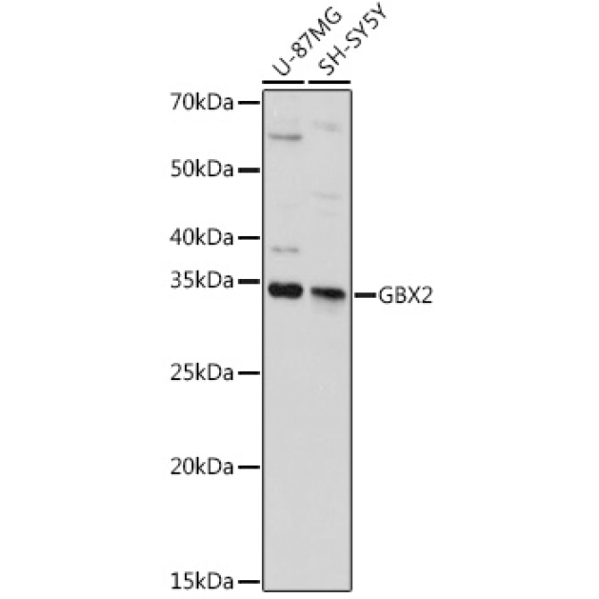 GBX2 Rabbit Polyclonal Antibody