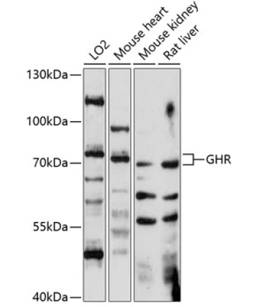 GHR Rabbit Polyclonal Antibody