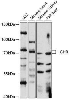 GHR Rabbit Polyclonal Antibody
