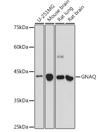 GNAQ Rabbit Polyclonal Antibody